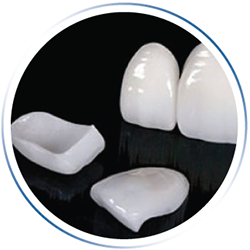 Lente de contato dental, você encontra na Odontopure Odontologia Osasco