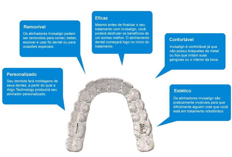Invisalign o aparelho praticamente invsível, na Odontopure Odontologia em Osasco 